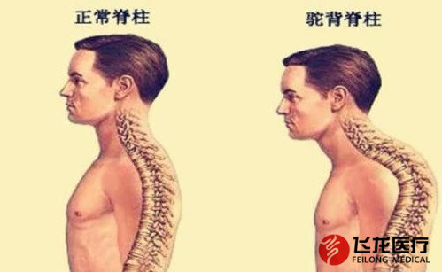 脊柱健康，不向生活&ldquo;低頭&rdquo;