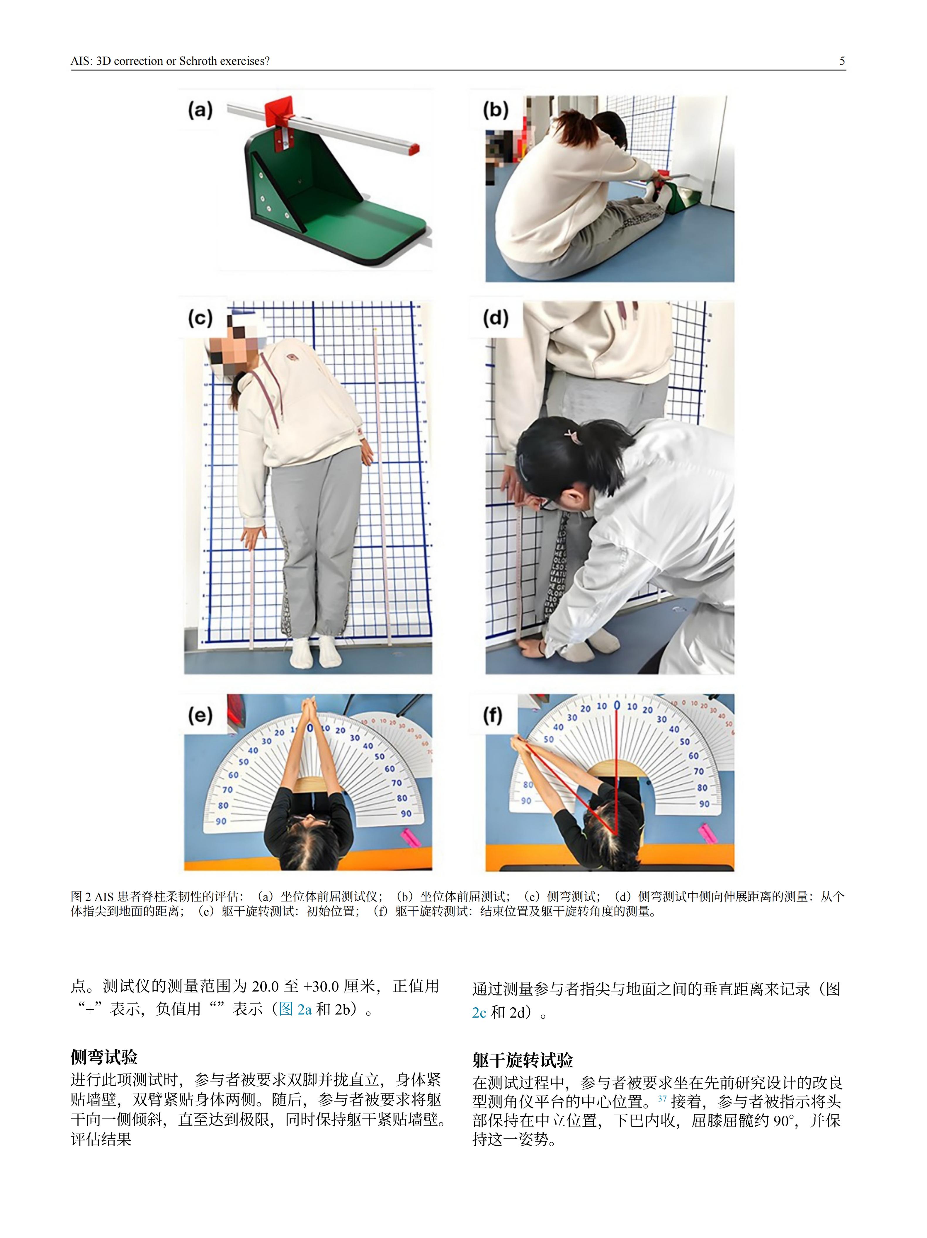 青少年特發(fā)性脊柱側(cè)彎患者采用先進(jìn)機(jī)械三維脊柱側(cè)彎矯正方案的效果